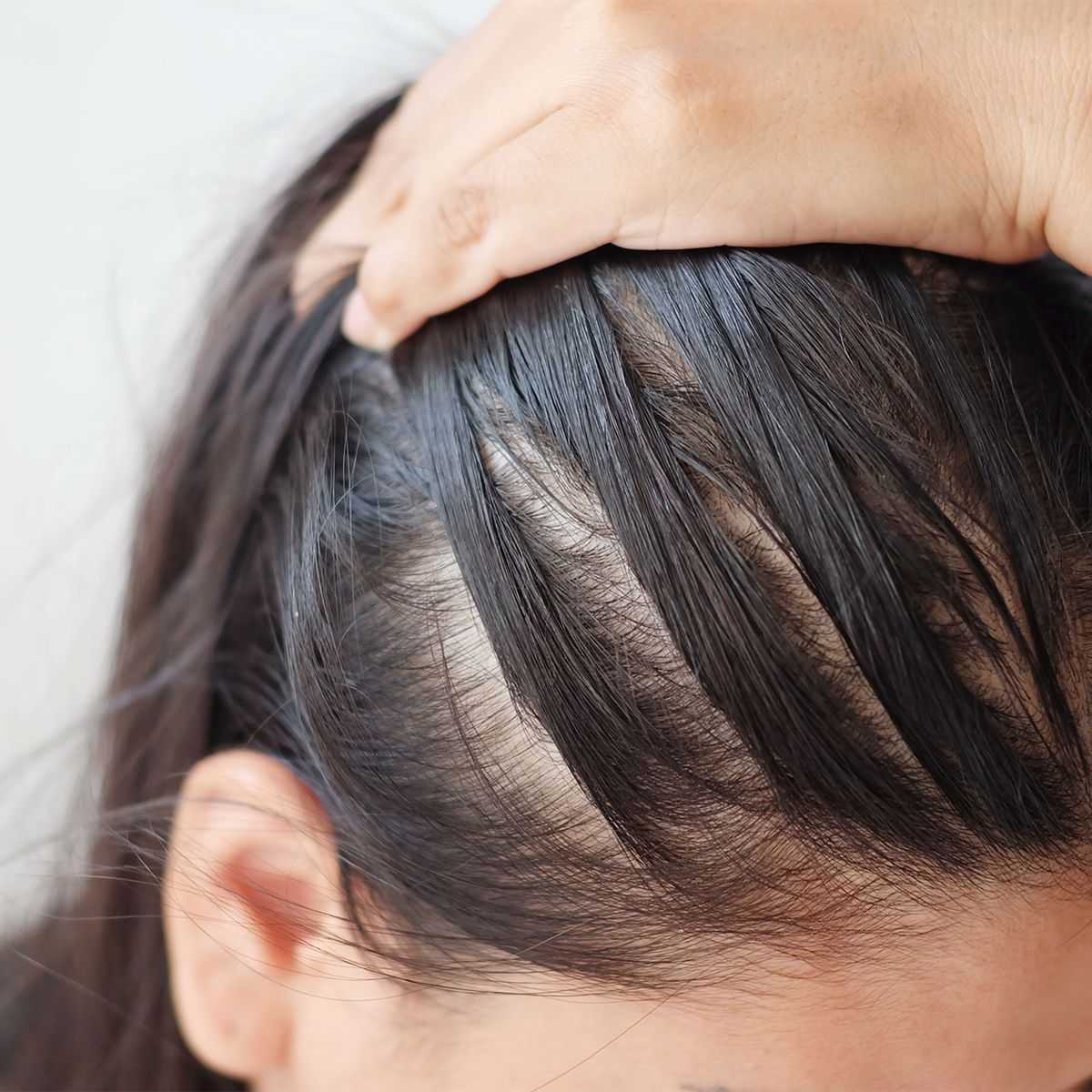 chute cheveux