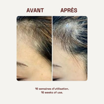 avant/après cheveux