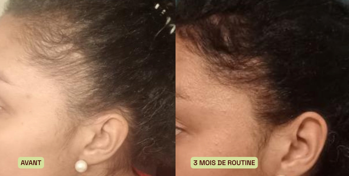 avant apres
