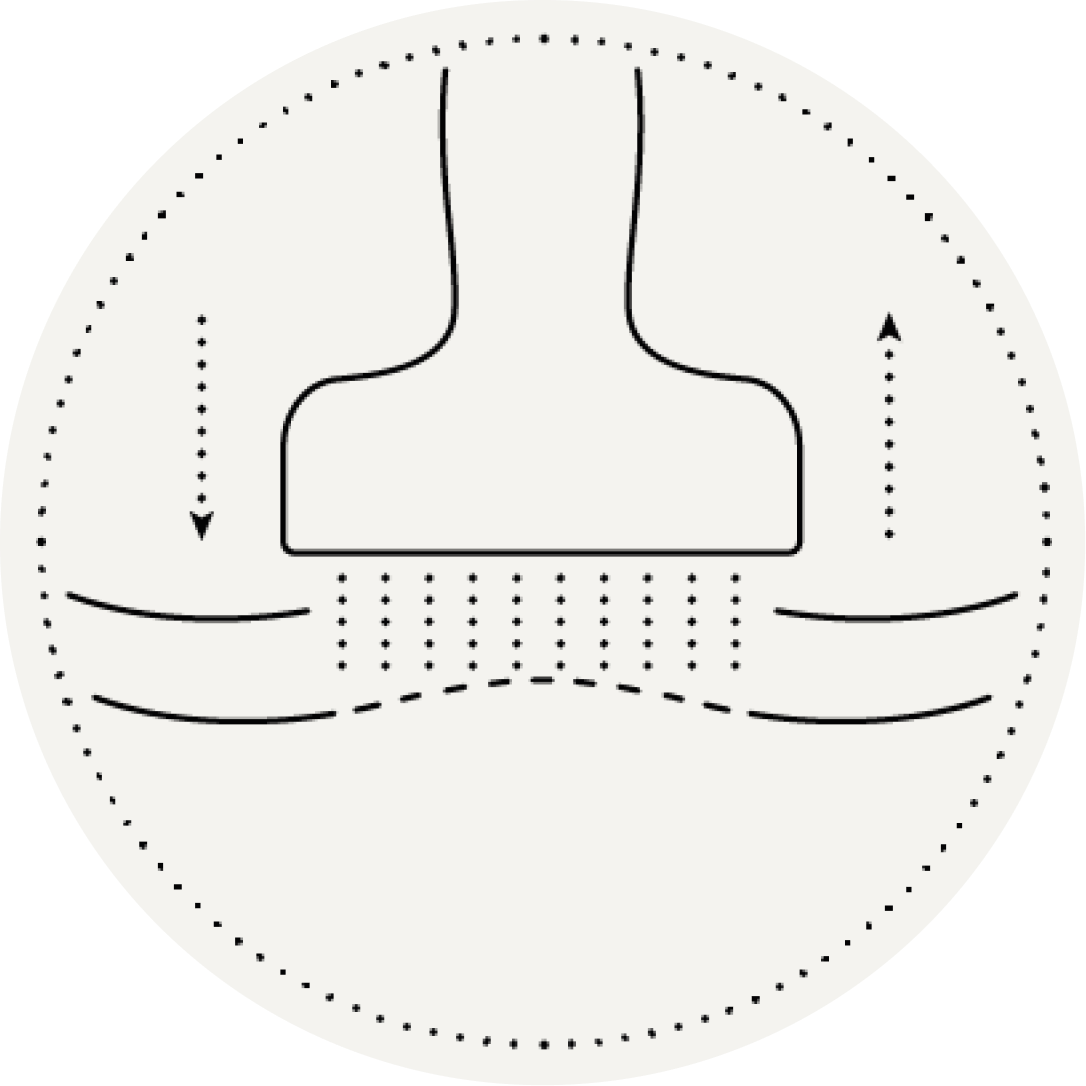 graphique dermastamp cuir chevelu 